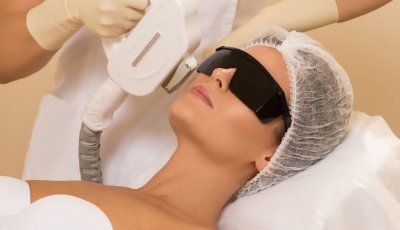 fotodepilación facial en Eibar